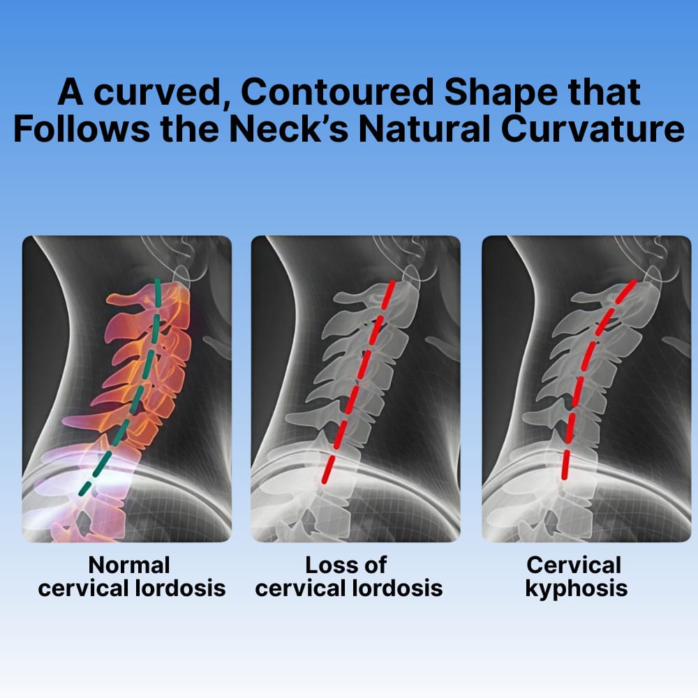ByeAche natural latex travel neck pillow illustration comparing normal, loss of lordosis, and kyphosis