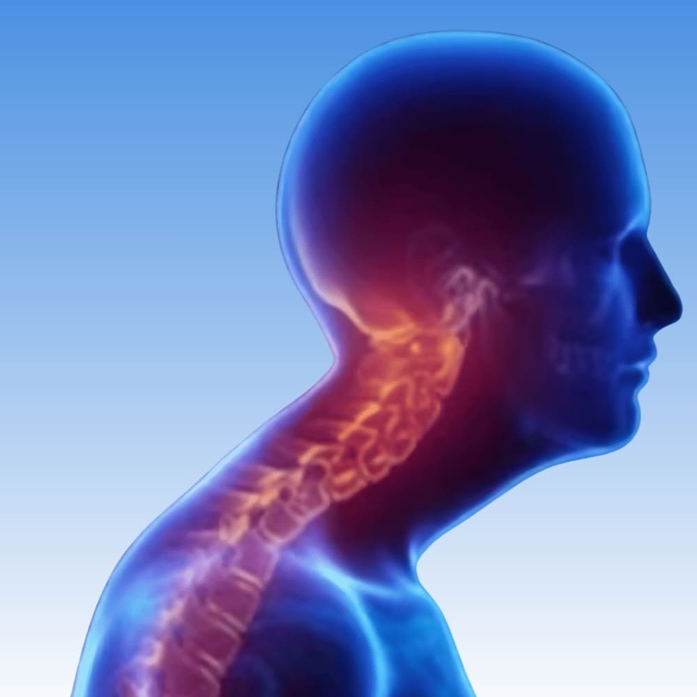 Neck-Maasager-before